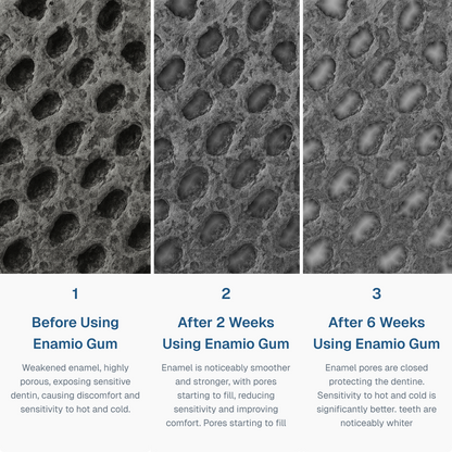 Enamio Remineralizing Gum